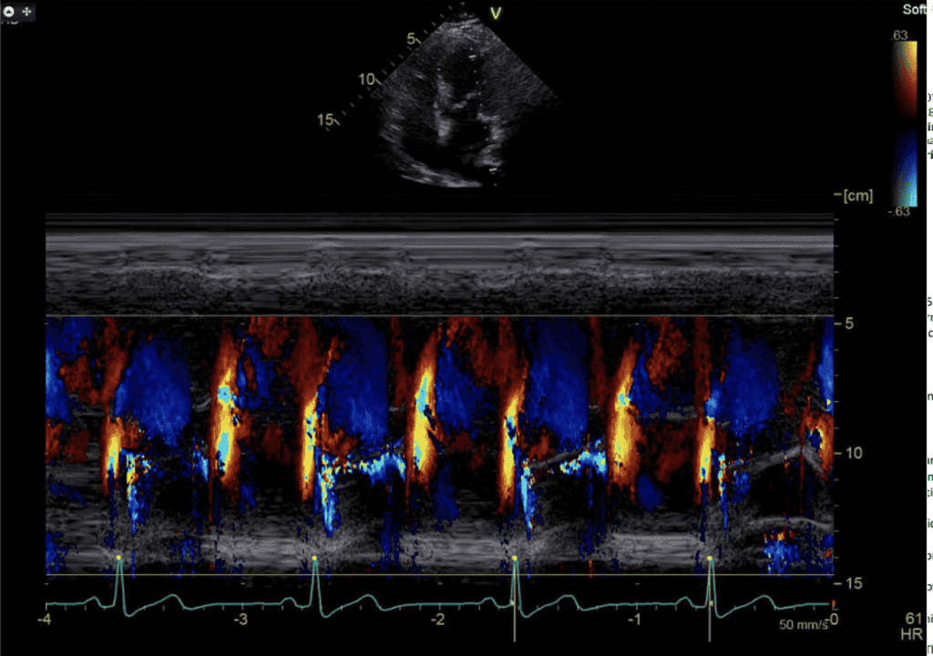 Empowering Physicians and Sonographers with IAME’s Advanced Ultrasound CME Solutions