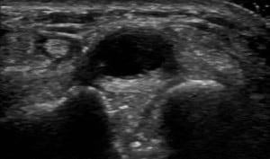 Ultrasound of the Hand and Wrist Case Series