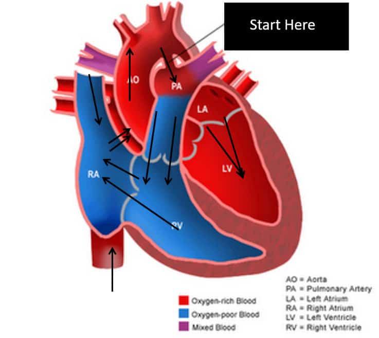 Fetal Right Heart Enlargement