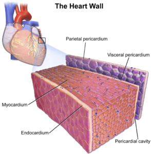 Pericardial Effusion, heart, echocardiography